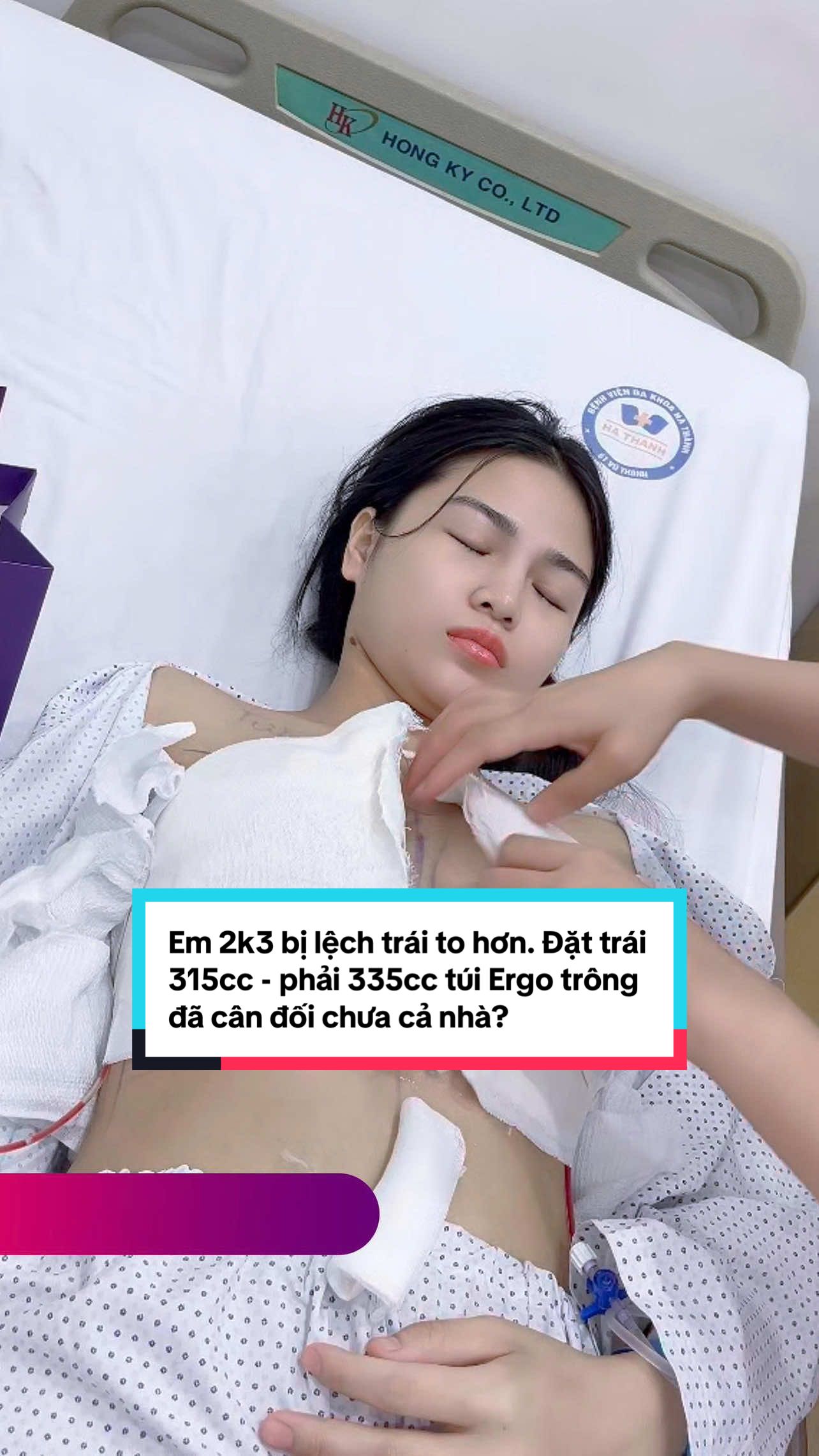 Đặt trái 315cc - phải 335cc trông đã cân đối chưa cả nhà? #xuhuong #nangv1 #drtranquanghoa 