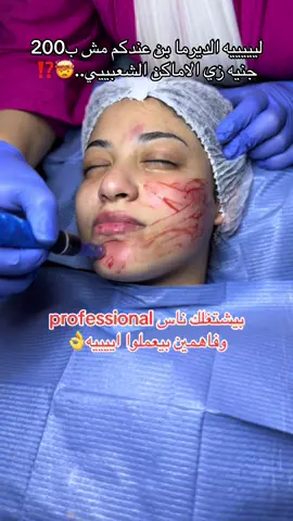 الديرما بن عندنا بشكل احترافي مع متابعه بعد الجلسه ابعتلنا عشان تعرفي عروض الديرما بن  #ديرمابن_dermapen #ديرمابن_فوائدها_feedbaak #ديرمابن #عنايه_جمال #عنايه_بشره 