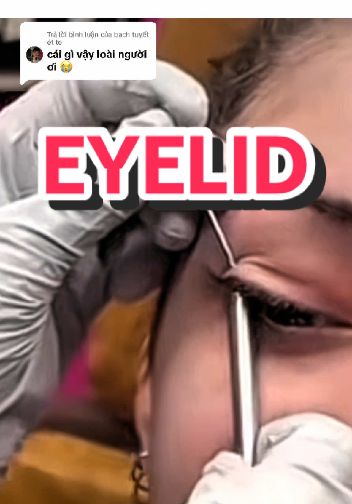 Trả lời @bạch tuyết ét te EYELID - BẠN DÁM KHÔNG? tui không dám 🤣 #piercing #viggapiercing #eyelid #eyelidpiercing #thegioi 