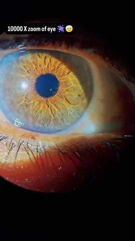 10000 x zoom of eye 😱🔥 🫟🤕 #eye #ophthalmology #oftalmologia #medicine #doctor 