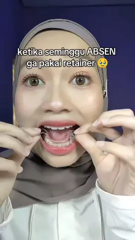 makin males pakai retainer 😓 soalnya ribet banget 🥹 #retainer #bracesoff #bracesjourney 