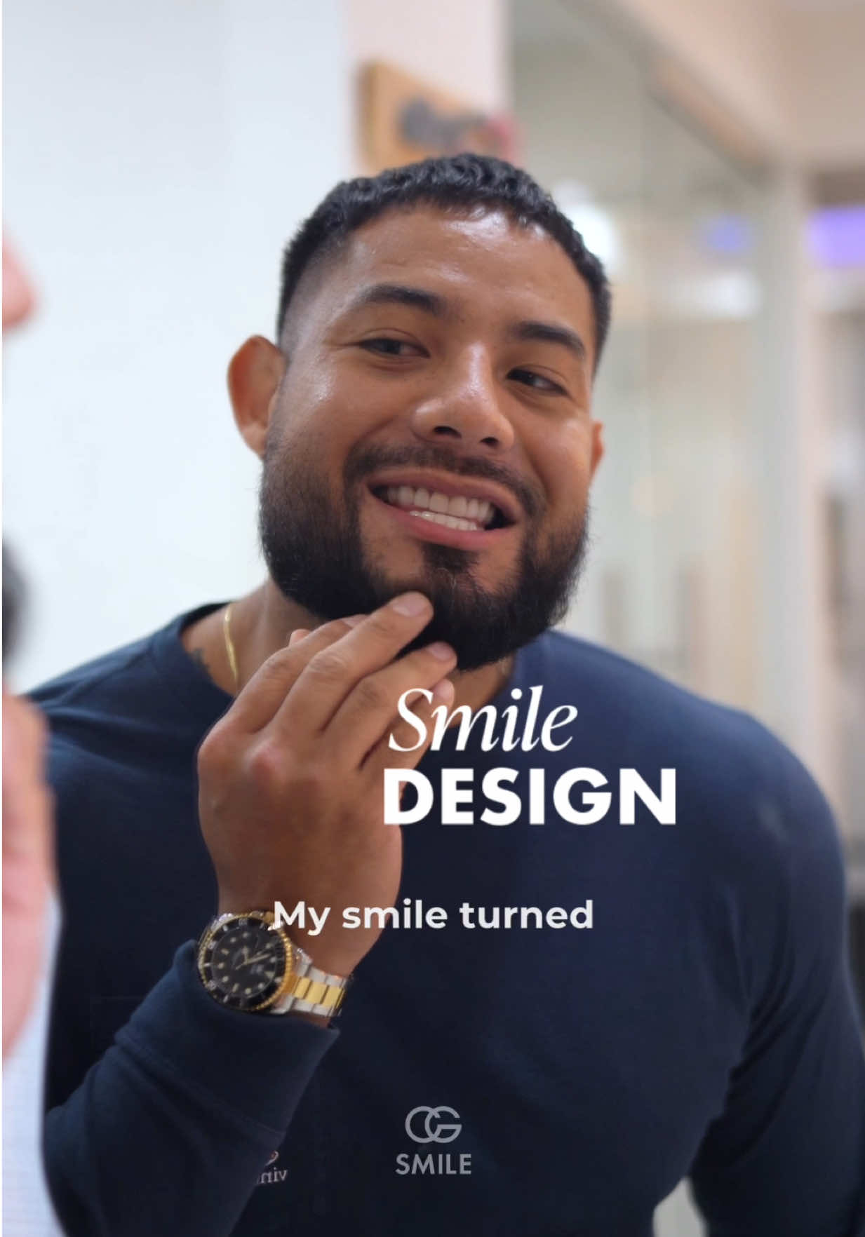 Say goodbye to stains, gaps, and chips. Hello to the smile you’ve always wanted. 😄🦷 #cgsmile #veneers #smiledesign 