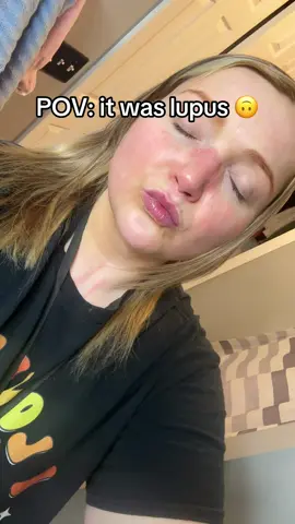 #lupus #autoimmunedisease #autoimmune 