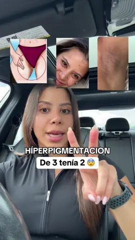 De 3 tenía 2 estos pads me salvaron @JiYu Skin #creatorsearchinsights #axilasoscuras #manchasenlapiel #koreanskincare #axilas 