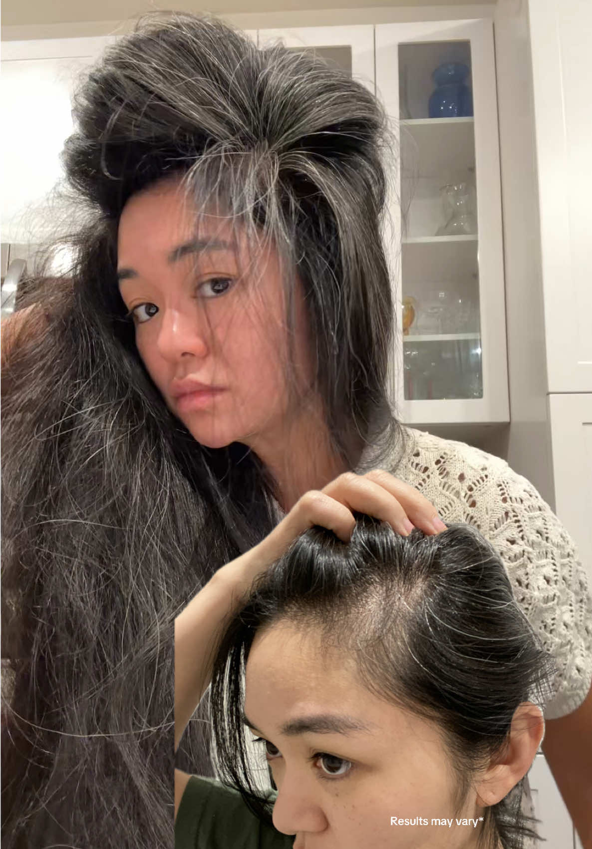 I am not crying anymore #hairgrowthtips #hairgrowthjourney #hairserum #hairgoals #hairloss New Year’s Resolution  