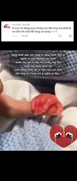 Bác sĩ nói chỉ có điều kì diệu mới giữ đc con ở lại, các bộ phận của con câng phẫu thuật để goàn thiện và vô cùng tốn kém, vượt ngoài khả năng của ba con... ba con chỉ biết cầu xin mọi người giúp đỡ con một chút để con được đón ánh mặt trời như bao đứa trẻ khác, hoặc để lại cho con một câu chúc bình an để bố con con có động lực tiếp con đường phía trước... #xuhuong #viral #baby 