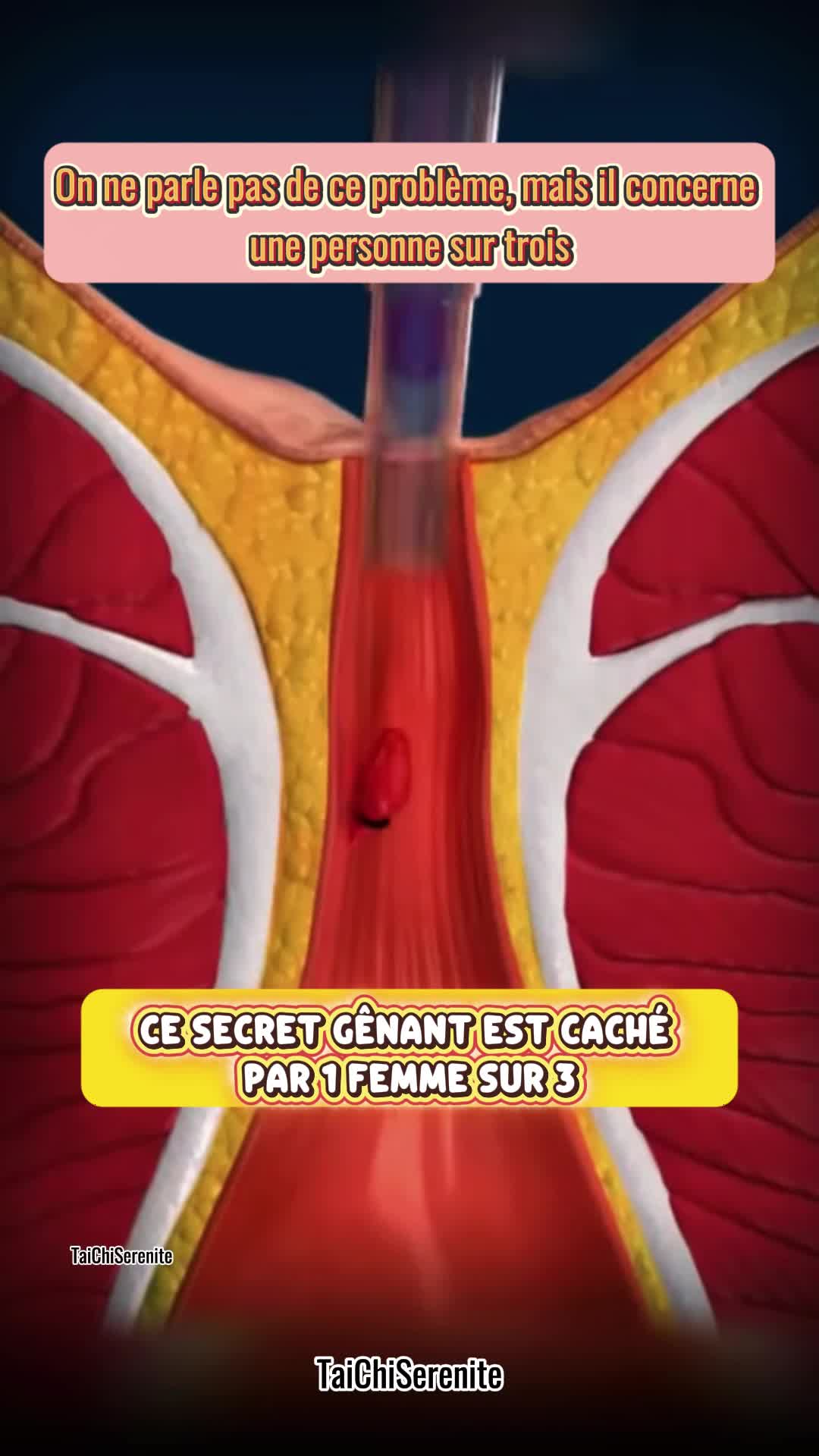 😶 Une femme sur trois cache ce problème… Douleurs, brûlures, gêne ? Ces mouvements simples soulagent en 7 jours. 💫 