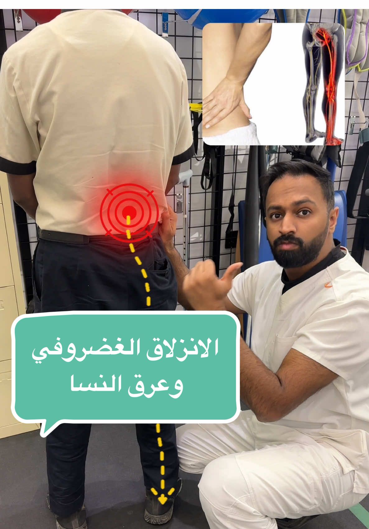 هذا التمرين من اكثر التمارين المثبتة علمياً في علاج الم الانزلاق الغضروفي وعرق النسا  . . . . #علاج_طبيعي #اسفل_الظهر #عرق_النسا #تمارين 