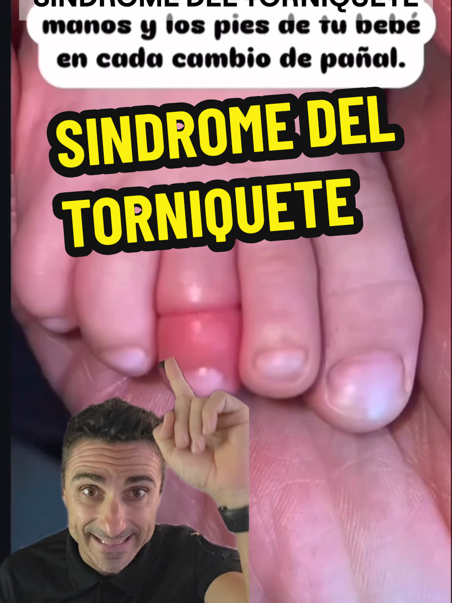 Sindrome del torniquete. . #salvarvidas #emergencias #primerosauxilios #urgencias #prevencion 