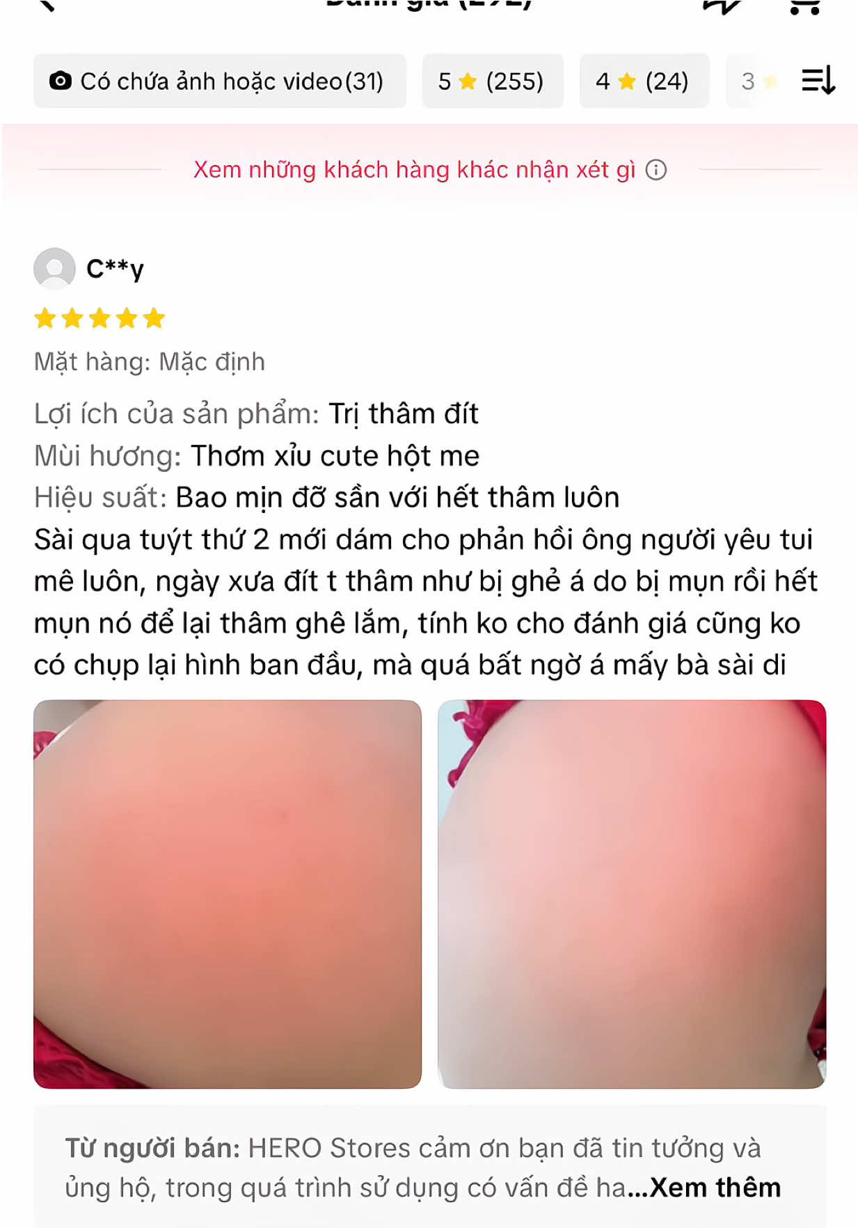 Đọc đánh giá cái 🍑 của bà nào mê quá dị nè chèn. Thâm mông, bẹn,….. ngày 2 lần sáng tối cho nhanh hết thâm nhen#body #bodycare #thammong #motham #v3 