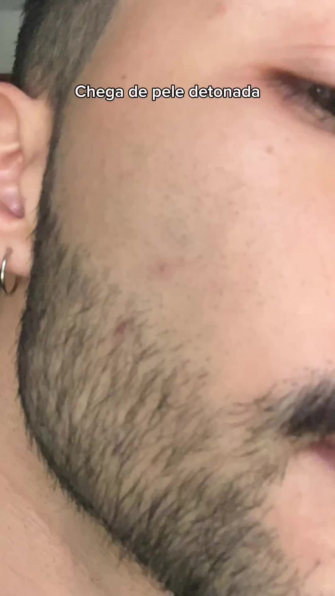 Não aguenta mais a sua pele com espinhas, cravos e oleosa? O @arturcarval tem uma dica para você! 👀