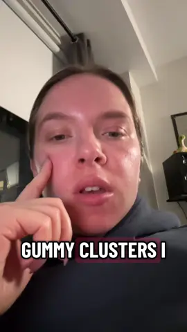 Devastating really. My precious are little pellet shaped candies. #nerdsgummyclusters #comedy #jokes #newyork #manhattan