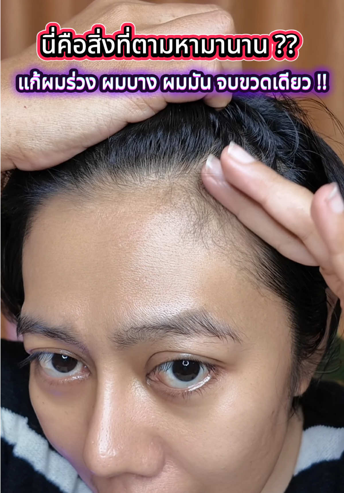 แชมพูสมุนไพร SAFEMILD (เซฟไมลด์) 🌿 ที่ออกแบบมาเพื่อช่วยดูแลโดยเฉพาะ ด้วยสารสกัด โสมเกาหลี ที่ช่วยบำรุงรากผมให้แข็งแรง ลดการหลุดร่วง และ เหอซั่วอู (Polygonum multiflorum) สมุนไพรจีนที่ขึ้นชื่อเรื่องทำให้ผมดกดำ เงางาม และดูหนามีน้ำหนัก ใช้เป็นประจำทุกวัน ช่วยให้ผมสะอาด บำรุงลึกถึงราก ดูสุขภาพดีขึ้นอย่างเป็นธรรมชาติ อย่าปล่อยให้ผมร่วงทำให้เสียความมั่นใจ 💕 กดตะกร้าตอนนี้ แล้วมาเริ่มต้นเส้นผมใหม่ที่แข็งแรงไปด้วยกันค่ะ ✨”#แชมพูสมุนไพร #ผมร่วงผมบาง #แชมพูปลูกผม #safemild #บํารุงรากผม 
