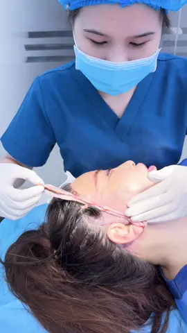 Căng da mặt sẽ thay đổi khách hàng ntn?#xuhhuong #pttm #cangdamat #viral #trending #fyp #foryoupage 