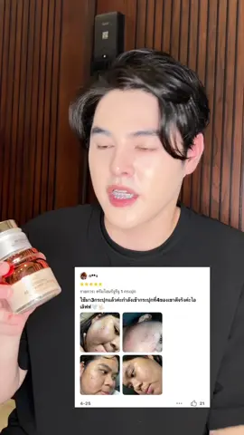 ลดสิว หน้าใสฉ่ำ! #founderskin #ฟาวเดอร์สกิน 