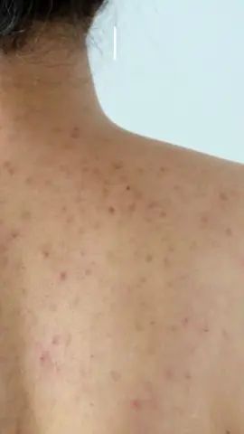 Try it today !!!  @vtcosmetics_global @4am.kr #VTCosmetics #Glycolicacid #Exfoliatingmist #Headtotoemist #Amazonfinds