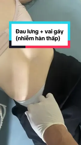 Khám và điều trị đau lưng và vai gáy do phong hàn thấp #đauvaigáy #đaulưng #phonghàn 