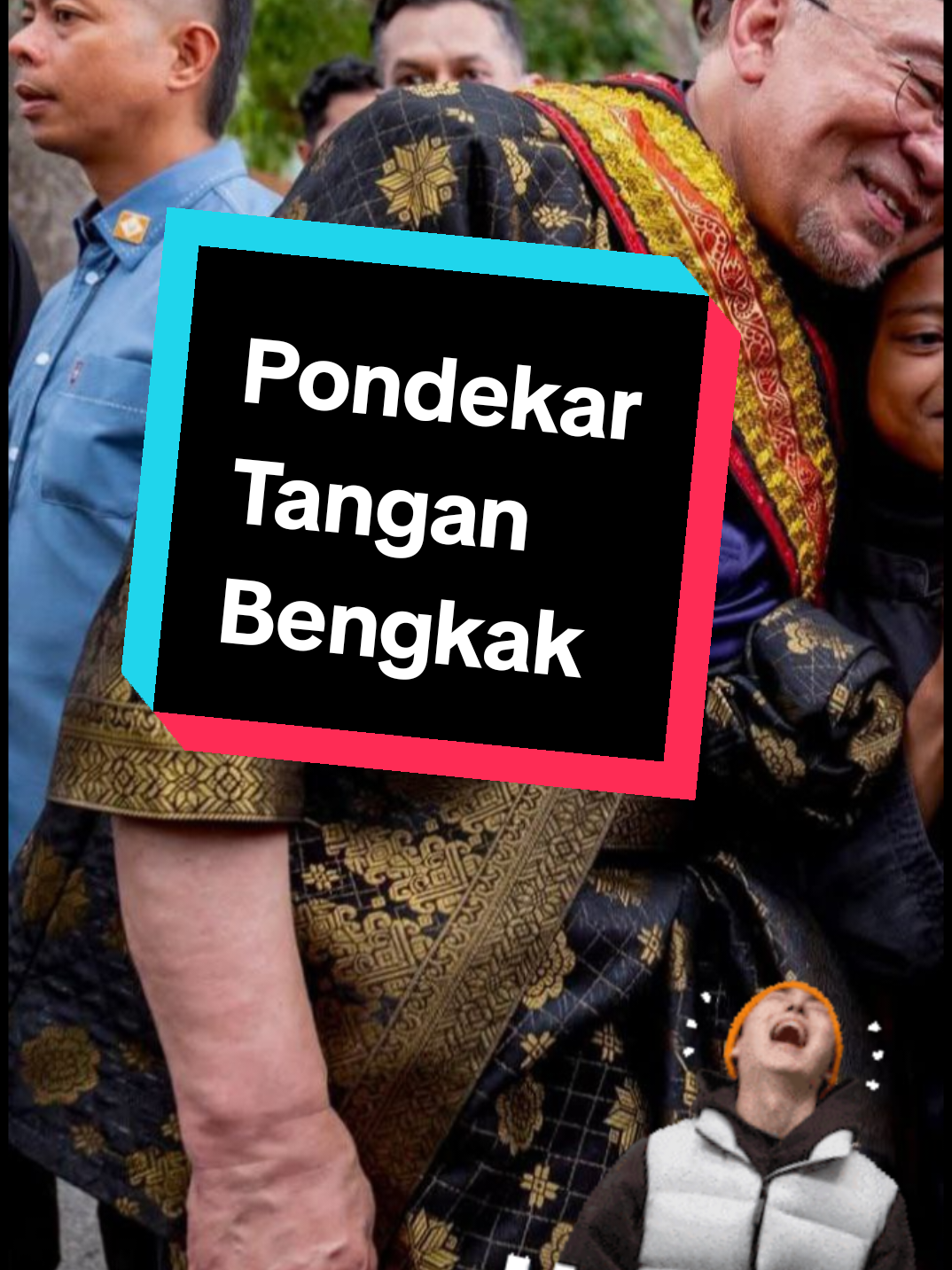 Pondekar tangan bengkak #tiktokviral #tiktokmalaysia #fyp #foryou #TurunAnwar 