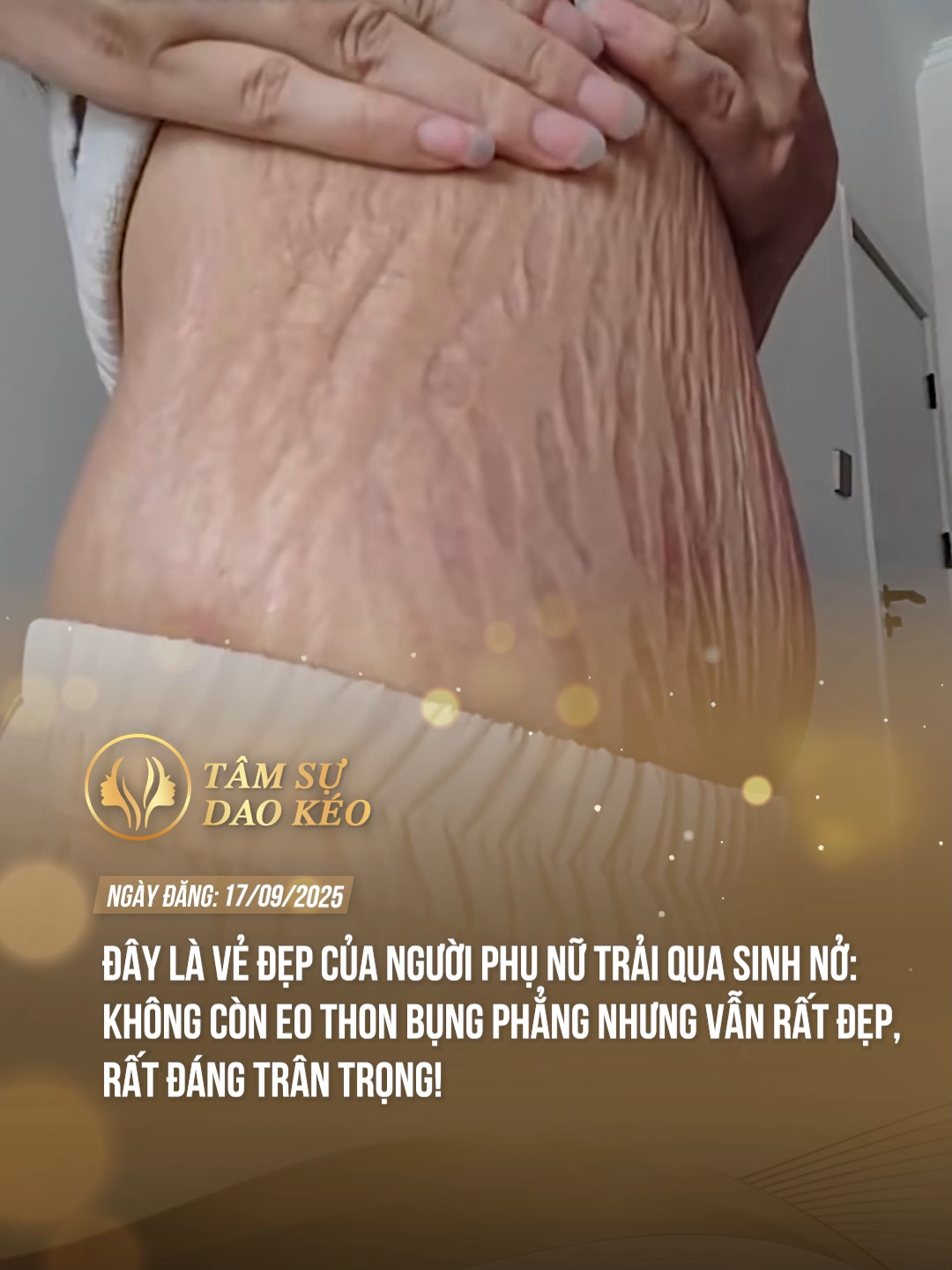 Chưa bao giờ thấy rạn da đẹp đến thế! #tamsudaokeo #theanh28 #tiktoknews #thammy #fypツ