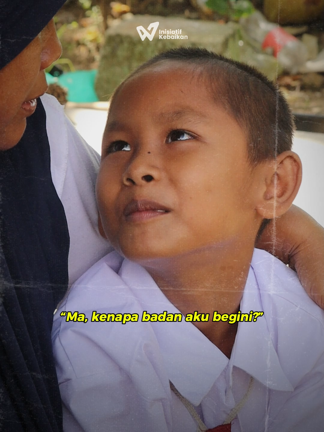 Stop bullying! Jangan sampai ada lagi korban. Robi (12 Tahun) mengalami perundungan beberapa tahun lalu oleh teman-temannya yang mengakibatkan tulang punggungnya patah, jalannya tak normal, penglihatannya tak jelas, bahkan koordinasi tubuhnya pun terganggu hingga ia seringkali terjatuh. Serangkaian pemeriksaan dan proses pengobatan seharusnya Robi jalani, mulai dari fisioterapis hingga ke psikolog karena Robi jadi pemalu dan penakut saat bertemu orang. Sayangnya, Ibunda Robi, Bu Poniman hanya seorang penjual kopi dan gorengan keliling dengan penghasilan tak seberapa. Bu Poniman kesulitan biaya pengobatan, Gizi dan Pendidikan Robi. Bantu ia sekarang juga! Donasi akan disalurkan dalam bentuk: ✅Membantu biaya terapi fisik, bicara, dan obat-obatan Robi ✅ Membantu kebutuhan harian seperti makanan dan transportasi sekolah ✅ Menyediakan modal usaha agar Bu Poniman bisa berdagang dengan lebih layak ✅ Mendukung pendidikan Robi hingga ia bisa mandiri #forhumanity #humanity #sharing #donation #donasi #berbuatbaik #kebaikan #communityservice #bantusesama #pedulisesama