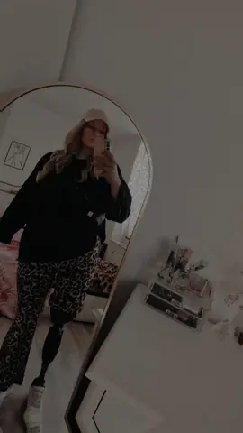 🥰🥰 #amputeegirl #amputeelife #amputee #loveyourself 