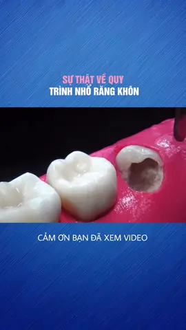 SỰ THẬT VỀ QUY TRÌNH NHỔ RĂNG KHÔN#LearnOnTikTok 