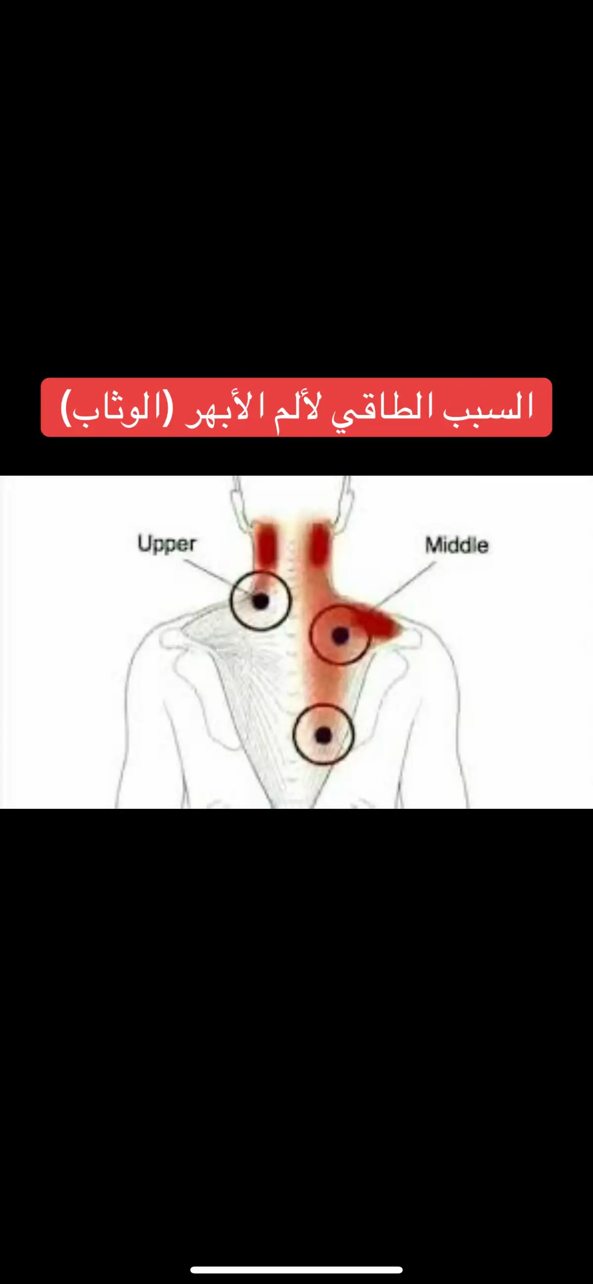 ألم الأبر (الوثاب) من منظور طاقي#شفاء #تأمل #سلام #chakra #meditation 