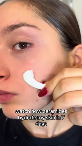 sometimes all you need is hydration 🩵  #skintific #ceramidemoisturizer #beforeafter #hydration #skincare 