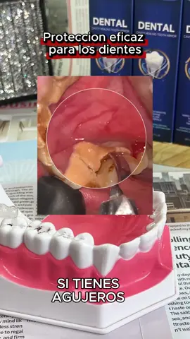#cavity #hydroxyapatite #yellowteeth #badbreath #tiktokmademebuyit 