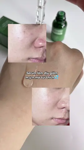 Dùng thấy giảm kichung với giảm đỏ nhanh nha. Mấy hôm da tui bị sần dùng ẻm buổi tối sáng hôm sau da đỡ hơn hẳn í @Caryophy Vietnam #lamdep #beauty #skincare #caryophy #serum 