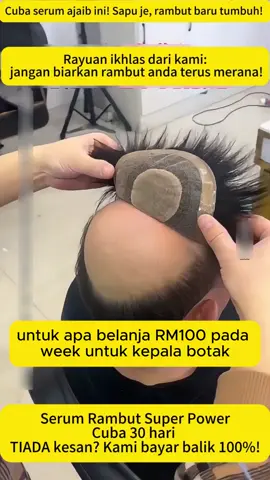 Lebih baik menjaga rambut anda daripada memakai rambut palsu! Gunakan cecair pertumbuhan rambut untuk memberikan sedikit kejutan kepada kepala botak anda