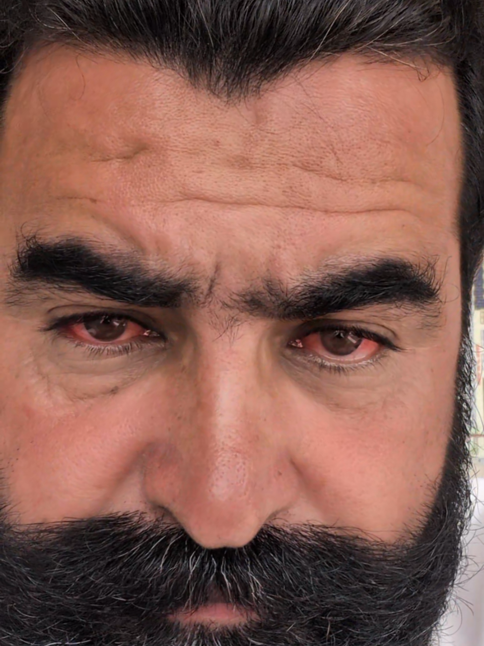 Eyes Red Filter..........