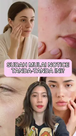 Kamu masih umur 20-30an tapi udah mulai ngerasa ada tanda-tanda ini? Hmmm ini udah saatnya kamu mulai konsumsi kolagen! Tapi jangan asal minum kolagen, pilih WNDRGREENS yang bisa memenuhi kolagen harian kamu ditambah dengan kandungan superfood lainnya untuk hasil yang maksimal 💖 #wndrgreens #minumankolagen #kolagen #astaxanthin #glutathione 