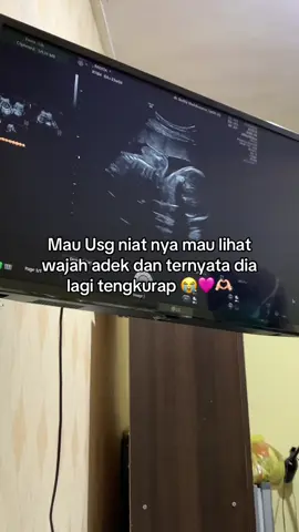 #masyaallahtabarakkallah #bumil #pregnant 