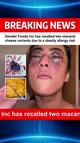Gooder Foods Inc. has recalled two Goodles macandcheese variants, 'Here Comes Truffle' and 'Vegan Is Believin’', due to the possible inclusion of unintended and undisclosed milk and cashew ingredients, according to the FDA.#fyp #News #Breakingnews #Recall 