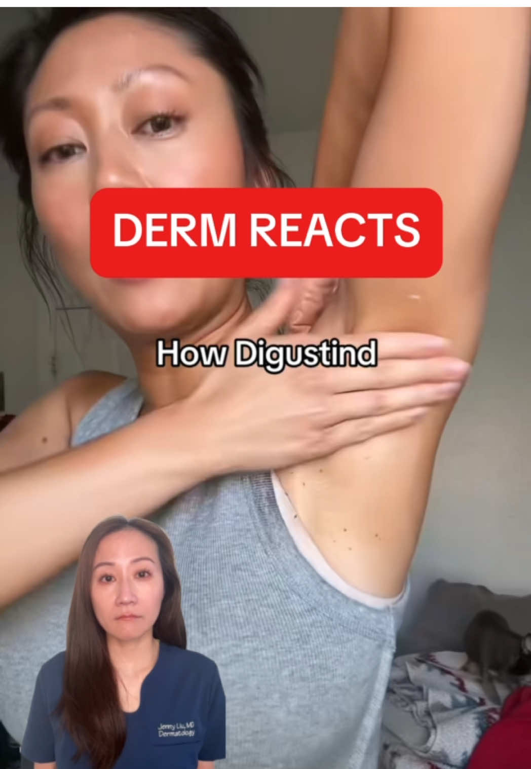 Underarm is sensitive area. I recommend addressing the cause first and then use gentle products to improve discoloration  over time @Dr Melaxin Official  #darkunderarms #underarmcare #darkarmpits #dermatologist #skintok 