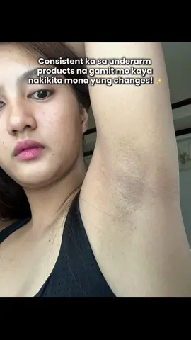 Pasintabi sa mahabang buhok pero share ko lang nagpatulong sa kili kili para mabawasan yung chicken skin saka hyperpigmentation niya 🥹 #underarmskincare #glycolicacid #niacinamideserum #dermorepubliq #SelfCare 