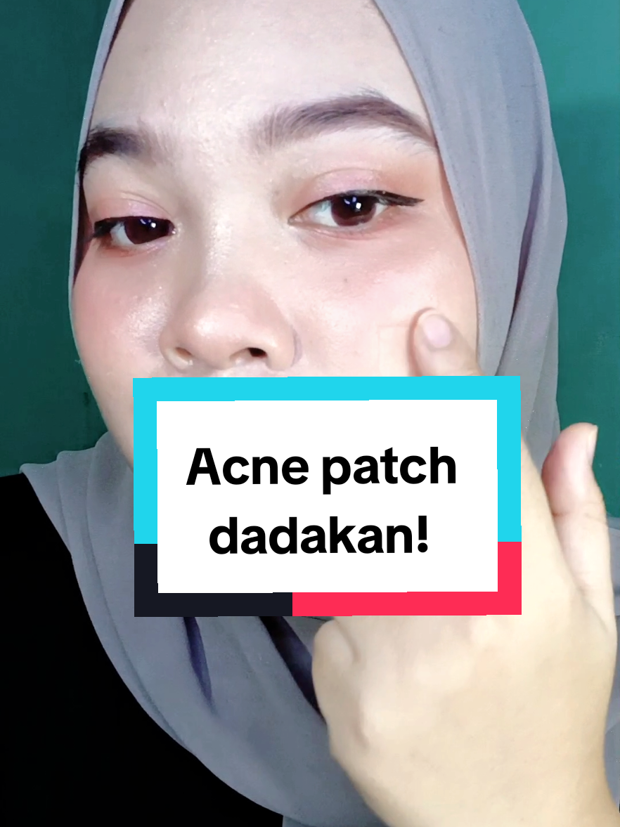 Siapa sangka plester dari @Hansaplast Indonesia ini bisa jadi penyelamat jerawatku?”#Hansaplast #Secondskin #HealFasterLikeSecondSkin #TenangBawaHansaplast #acnepatch 
