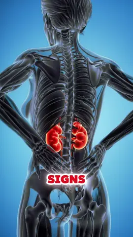 five pain signs that you may already have kidney failure #kidneyfailure #kidneydisease #kidney #pain #usa 