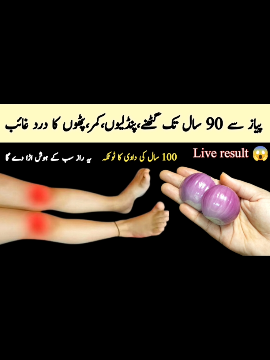 You will not have knee pain for 90 years with just remedy of magic Onion | knees pain | joints pain