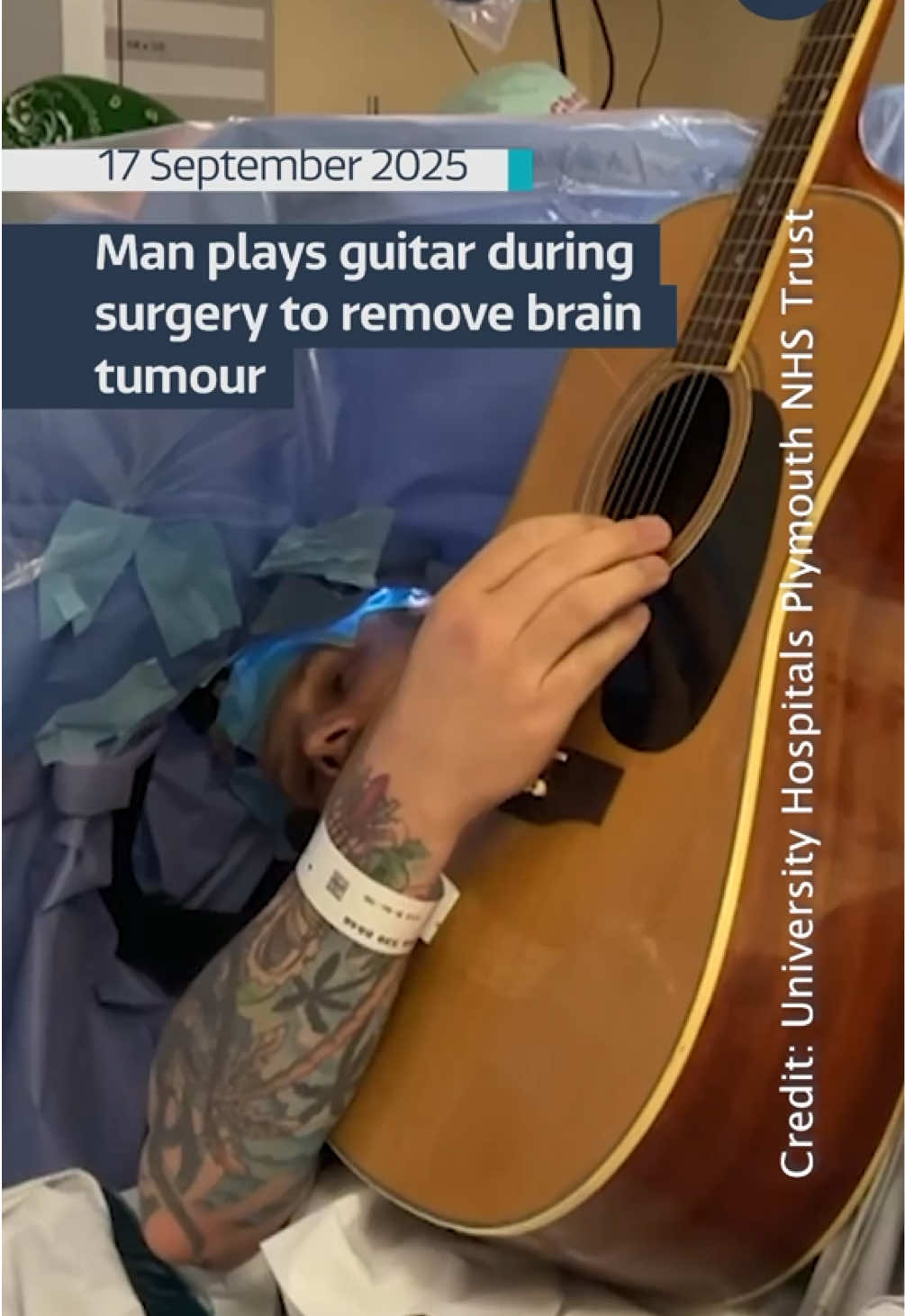 A man from Plymouth was filmed playing playing the guitar, all while undergoing brain surgery. Paul Welsh-Dalton had an operation to remove a tumour. Not only did the medical team keep him awake, they also encouraged him to play his favourite song so they could monitor his brain activity. #itvnews