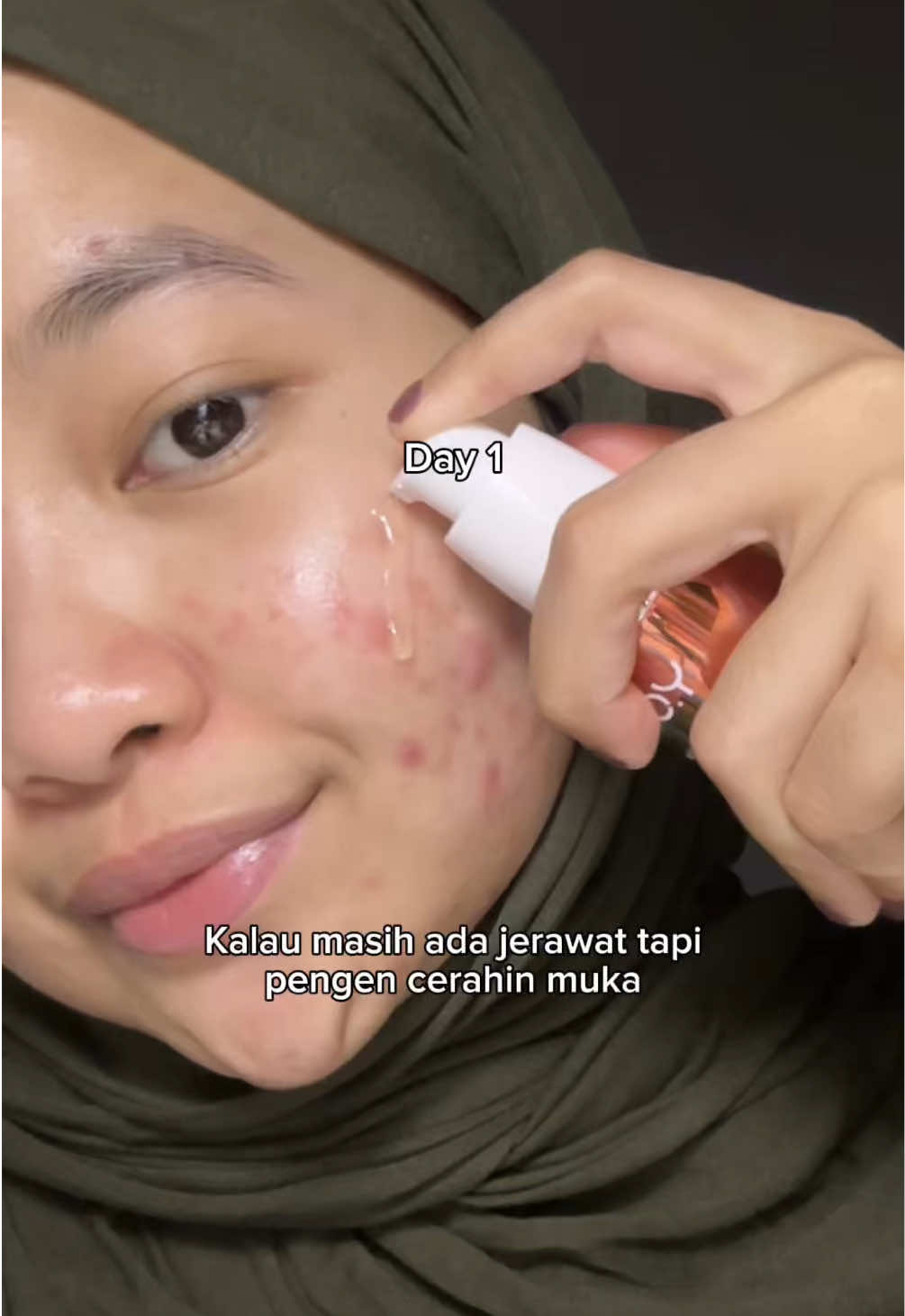 kataku sih langsung checkout skrg serum terbaru dari @YOU Beauty Indonesia !! 💗💗💗 #you #youserum #youserumradianceup #brighteningserum #acnescars 