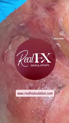 What is Moulage? Its the process of creating REAL lifelike injuries and medical conditions on human simulated casualties, manikins, or patient simulators, using FX makeup, products, skills and techniques to enhance the realism of medical training, education, and SIMULATION. #moulage #simulationhealthcareweek #simulation #sfxmakeuptutorial #medicalsimulation 