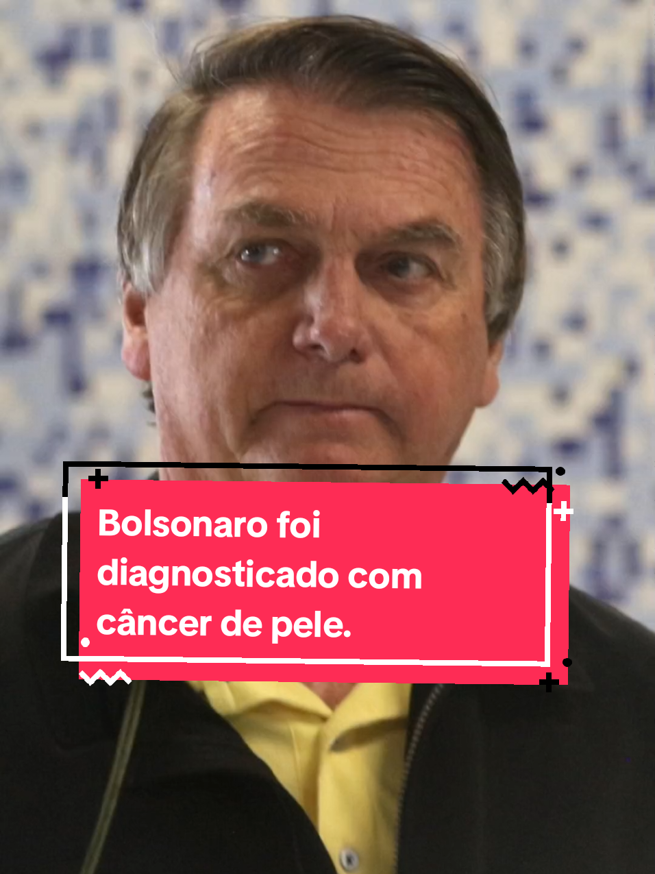 o ex presidente Bolsonaro foi diagnosticado com câncer de pele. #bolsonaro #cancer #noticias 