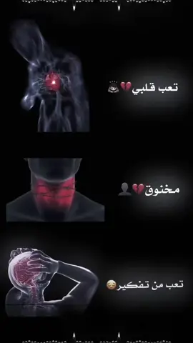 كذابين#مخنوق #راسي عم يوجعني من كثر التفكير فيا#ك #راسي #💔🫩🫩
