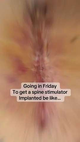 #thrutheireyes 
