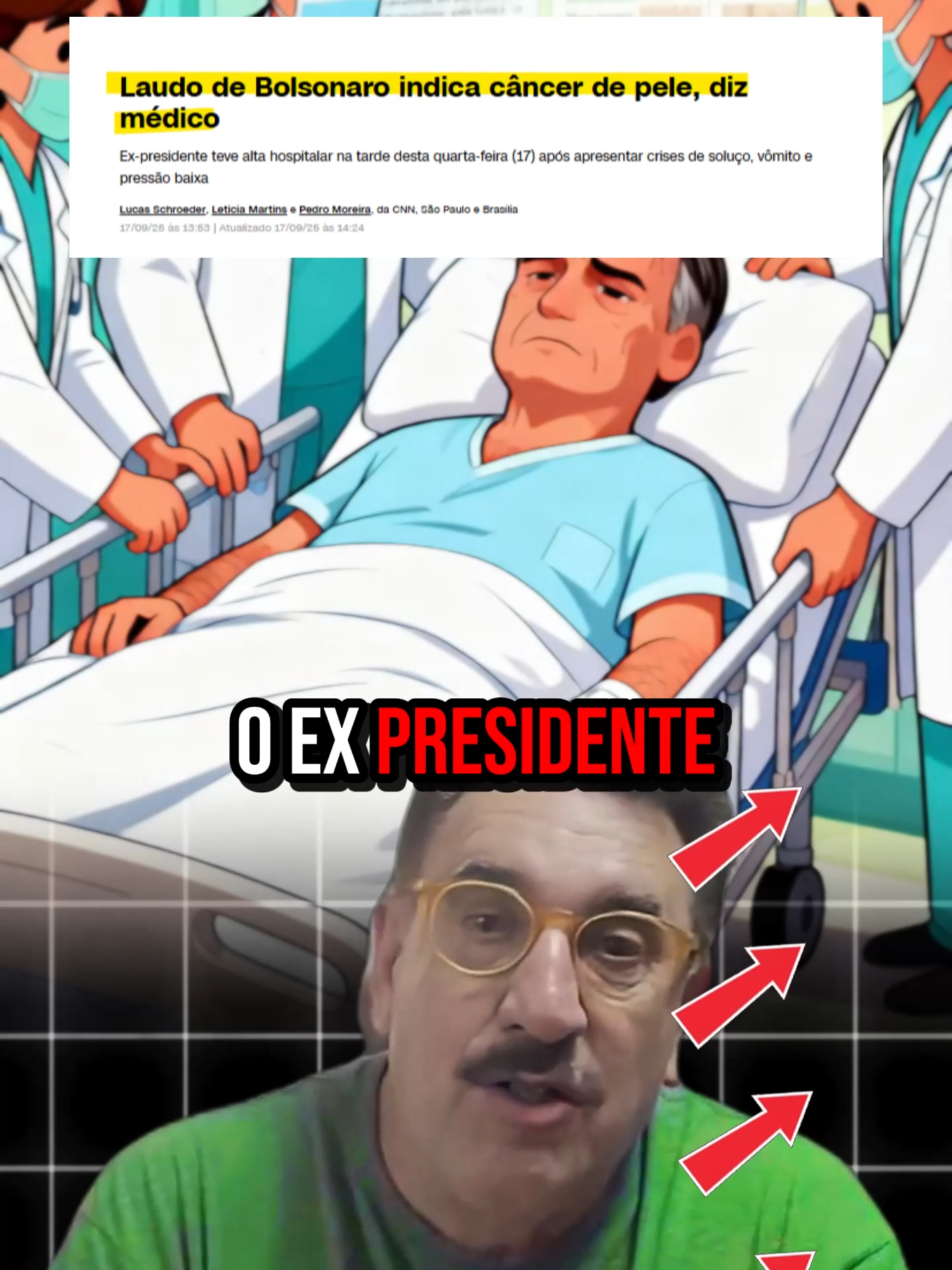 “Bolsonaro hospitalizado em Brasília: vômito, soluço e queda de pressão! Receita médica confirma câncer de pele em estágio inicial após remoção de lesões. Alta hospitalar anunciada, mas a saúde dele volta ao centro do debate político. Fonte: Reuters, CNN Brasil. ⚠️ E você acha que esse episódio vai impactar a condenação dele ou mudar a imagem pública? Comenta aí! #viral #fyp #brasil🇧🇷 #noticias #bolsonaro