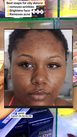 Mastering the Art of Black Soap for Glowing Skin #blacksoap, #skincare, #glowingskin, #howtotiktok,  #creatorsearchinsights 