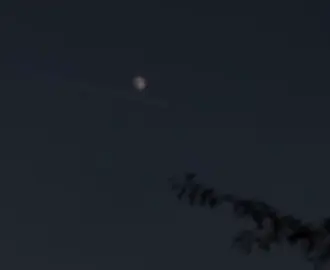 ئەوەندە درم تووند بوە  دنیا لە پێش جاوم رەش بوە..🥹#foruyou 