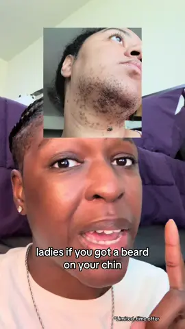 #creatorsearchinsights I can’t believe I didn’t know about these sooner‼️ #TiktokShopRestock #vitalsourcebifi #womenshormonebalance #womenshormonesupport  *Final Price / Discounts / Shipping may differ based on your TikTok account, available coupons, and current promotions. Always refer to product listing for up-to-date offers. * I am not a doctor and this is not medical advice. This is my personal experience and opinion based on my own research. Do your own research and ask your doctor for more information. *Results may vary.